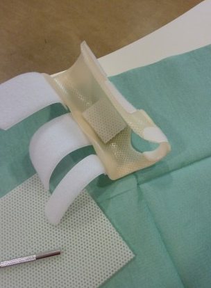 Plaque de silicone positionnée sur une orthèse de poignet